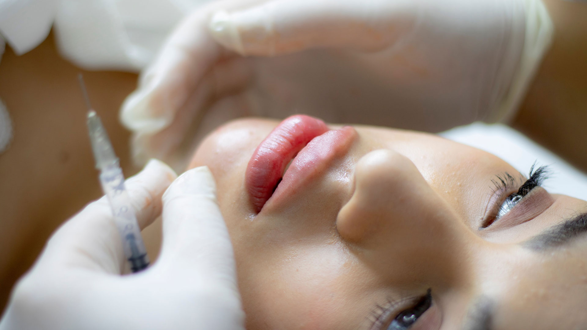 Filler viso Brescia | Dott. Riboldi Filler viso Brescia | Dott. Riboldi